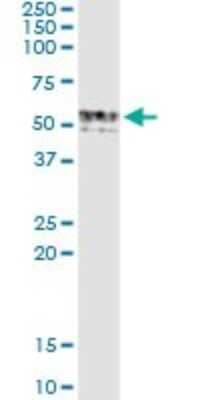 Western Blot: GIF Antibody (1D9) [H00002694-M03]