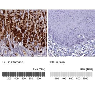 Immunohistochemistry-Paraffin: GIF Antibody [NBP1-81610]