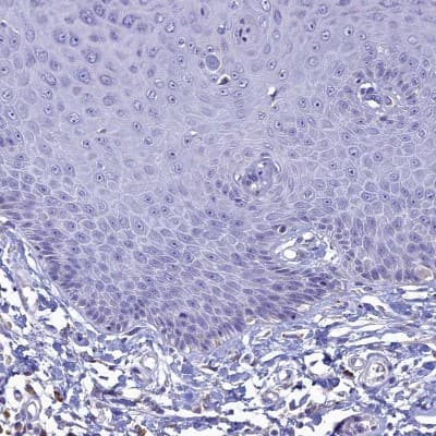 Immunohistochemistry-Paraffin: GIF Antibody [NBP1-81610]