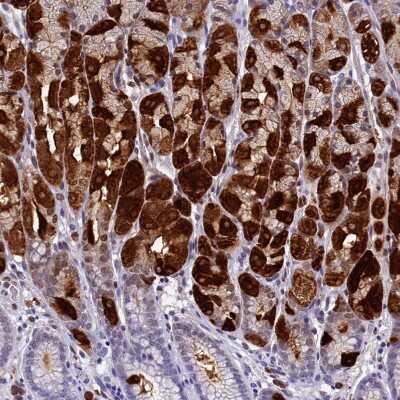 Immunohistochemistry-Paraffin: GIF Antibody [NBP1-81610]