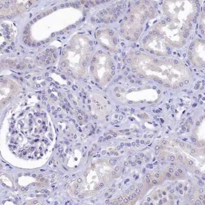 Immunohistochemistry-Paraffin: GIF Antibody [NBP1-81610]
