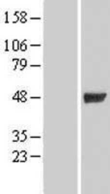 Western Blot: GIF Overexpression Lysate [NBL1-11069]