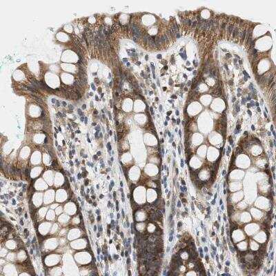Immunohistochemistry-Paraffin: GIGYF1 Antibody [NBP1-81785]