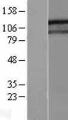 Western Blot: GIGYF1 Overexpression Lysate [NBL1-11070]