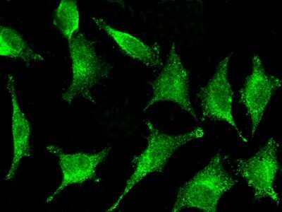 Immunocytochemistry/ Immunofluorescence: GILT/IFI30 Antibody (003) [NBP2-90133]