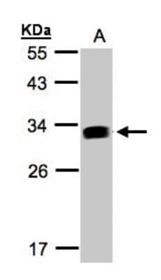 Western Blot: GILT/IFI30 Antibody [NBP1-32466]