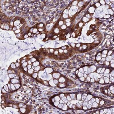Immunohistochemistry-Paraffin: GIMAP1 Antibody [NBP1-91940]