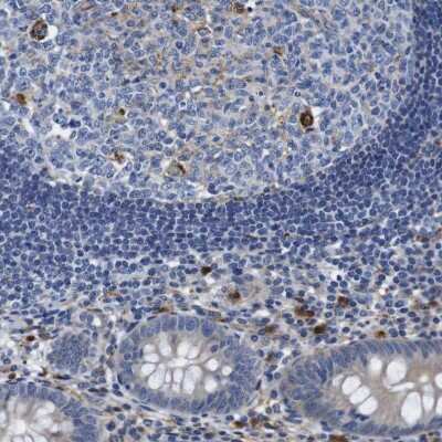 Immunohistochemistry-Paraffin: GIMAP2 Antibody [NBP1-85071]