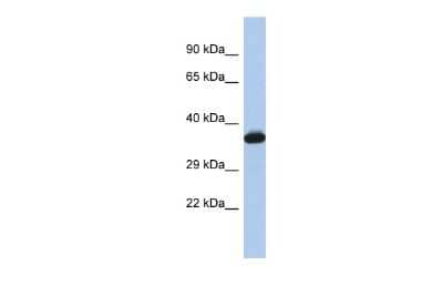 Western Blot: GIMAP2 Antibody [NBP2-87498]