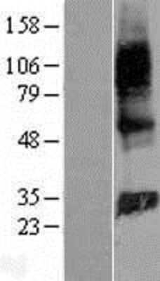 Western Blot: GIMAP2 Overexpression Lysate [NBP2-07136]