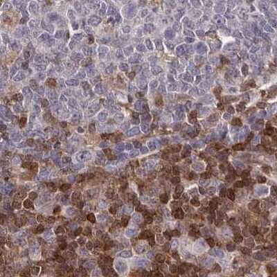 Immunohistochemistry-Paraffin: GIMAP4 Antibody [NBP1-83776]