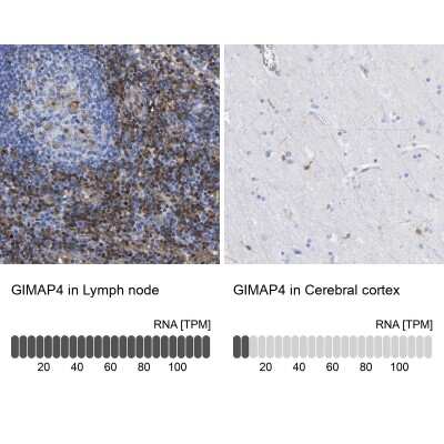 Immunohistochemistry-Paraffin: GIMAP4 Antibody [NBP1-83777]