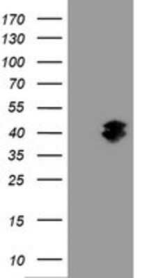 Western Blot: GIMAP4 Antibody (OTI1A11) [NBP2-45854]