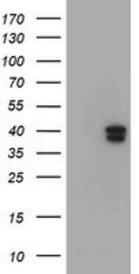 Western Blot: GIMAP4 Antibody (OTI1C6)Azide and BSA Free [NBP2-71997]