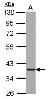 Western Blot: GIMAP4 Antibody [NBP2-16656]