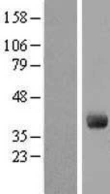 Western Blot: GIMAP4 Overexpression Lysate [NBL1-11073]