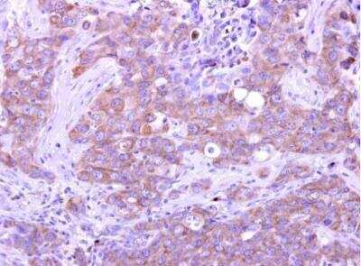 Immunohistochemistry-Paraffin: GIMAP5 Antibody [NBP1-31165]