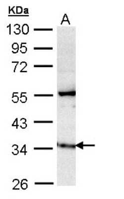 Western Blot: GIMAP5 Antibody [NBP1-31165]