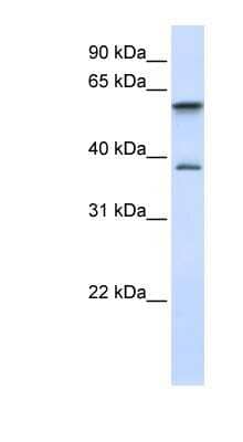 Western Blot: GIMAP5 Antibody [NBP1-59485]