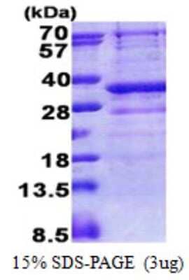 SDS-PAGE: Recombinant Human GIMAP5 His Protein [NBP2-23091]