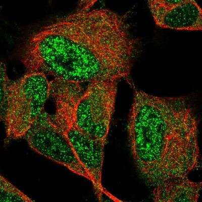 Immunocytochemistry/ Immunofluorescence: GIMAP6 Antibody [NBP2-76542]