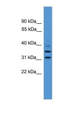 Western Blot: GIMAP6 Antibody [NBP1-79618]