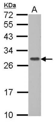 Western Blot: GIMAP6 Antibody [NBP2-16658]