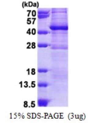 SDS-PAGE: Recombinant Human GIMAP6 His Protein [NBP2-23092]