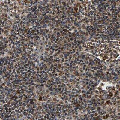 Immunohistochemistry-Paraffin: GIMAP7 Antibody [NBP1-81624]