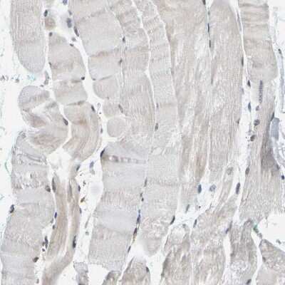 Immunohistochemistry-Paraffin: GIMAP7 Antibody [NBP1-81624]