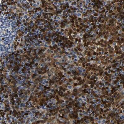 Immunohistochemistry-Paraffin: GIMAP7 Antibody [NBP1-81625]