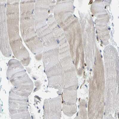 Immunohistochemistry-Paraffin: GIMAP7 Antibody [NBP1-81625]