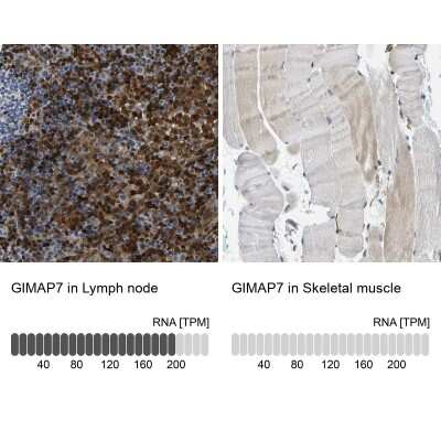 Immunohistochemistry-Paraffin: GIMAP7 Antibody [NBP1-81625]