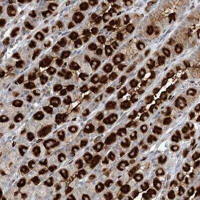 Immunohistochemistry: GIN-1 Antibody [NBP1-89856]