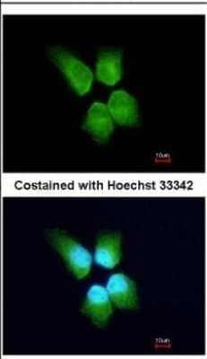 Immunocytochemistry/ Immunofluorescence: GINS4 Antibody [NBP2-16659]