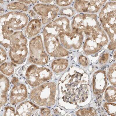 Immunohistochemistry-Paraffin: GINS4 Antibody [NBP1-82748]