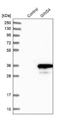 Western Blot: GINS4 Antibody [NBP1-82747]