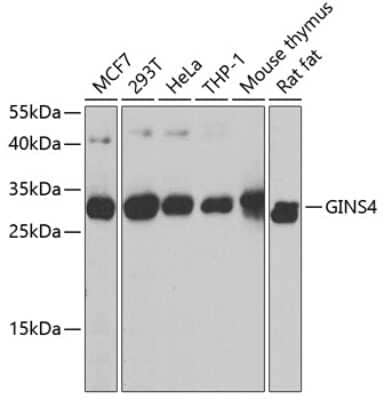 Western Blot: GINS4 AntibodyBSA Free [NBP3-04390]