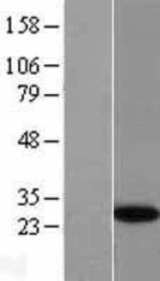 Western Blot: GINS4 Overexpression Lysate [NBL1-11079]