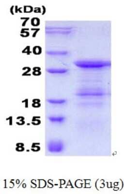 SDS-PAGE: Recombinant Human GINS4 His Protein [NBP2-23076]