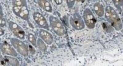 Immunohistochemistry-Paraffin: GIP Antibody (4) - BSA Free [NBP2-21617]