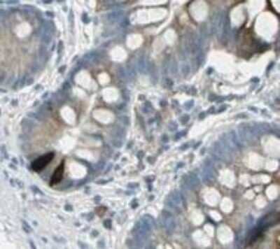 Immunohistochemistry-Paraffin: GIP Antibody (4) - BSA Free [NBP2-21617]