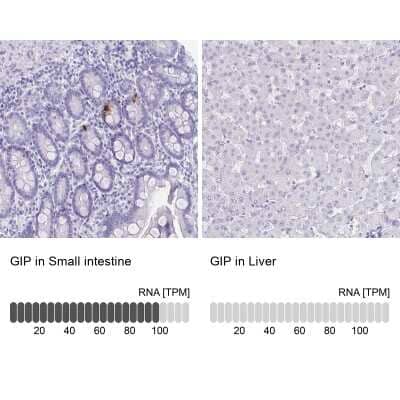 Immunohistochemistry-Paraffin: GIP Antibody [NBP1-86422]