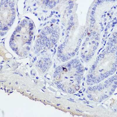 Immunohistochemistry-Paraffin: GIP Antibody - Azide and BSA Free [NBP3-04865]
