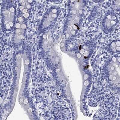 Immunohistochemistry-Paraffin: GIP Antibody [NBP3-17034]