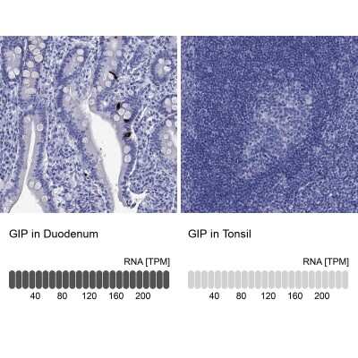 Immunohistochemistry-Paraffin: GIP Antibody [NBP3-17034]