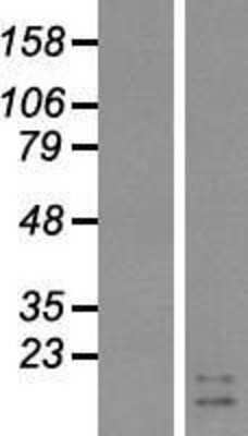 Western Blot: GIP Overexpression Lysate [NBP2-07909]