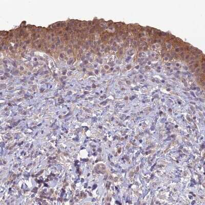 Immunohistochemistry-Paraffin: GIPC1 Antibody [NBP1-91941]