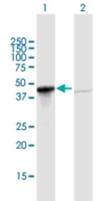 Western Blot: GIPC1 Antibody [H00010755-B01P]