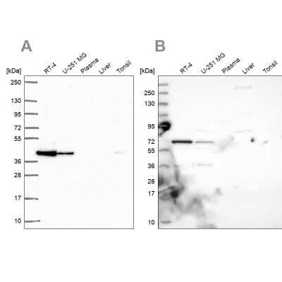 Western Blot: GIPC1 Antibody [NBP2-76557]